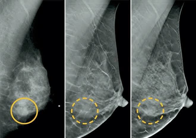 imagem sem descrição.